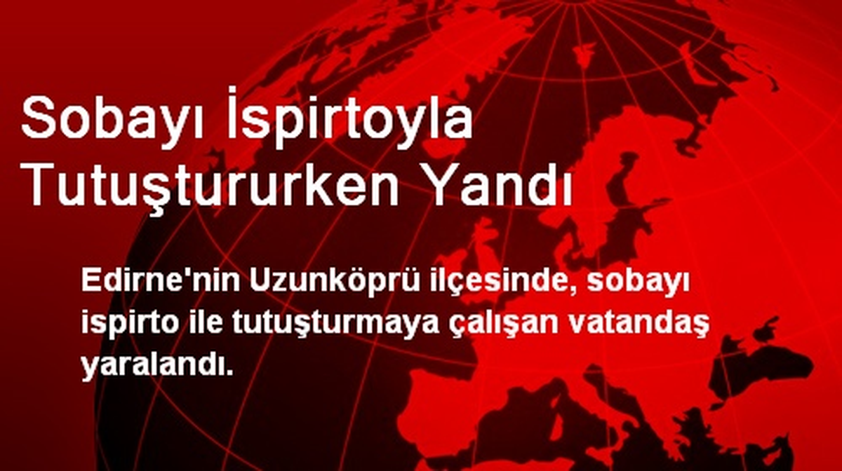 Sobayı İspirtoyla Tutuştururken Yandı