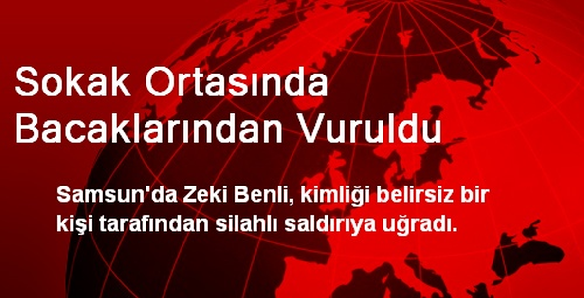 Sokak Ortasında Bacaklarından Vuruldu