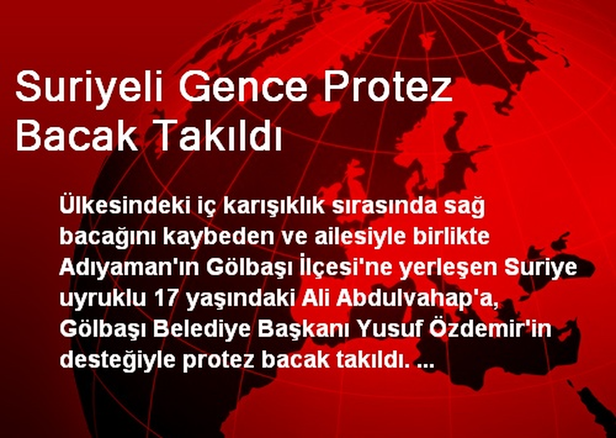 Suriyeli Gence Protez Bacak Takıldı