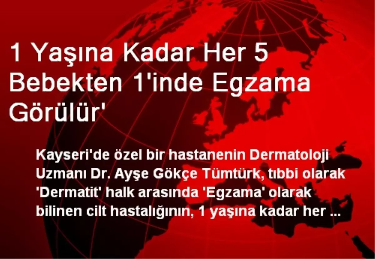 1 Yaşına Kadar Her 5 Bebekten 1\'inde Egzama Görülür\'