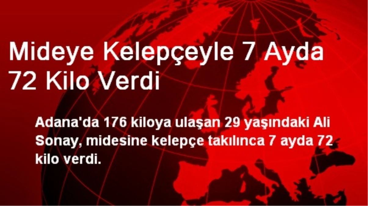 Adana\'da Mideye Kelepçeyle 7 Ayda 72 Kilo Verdi