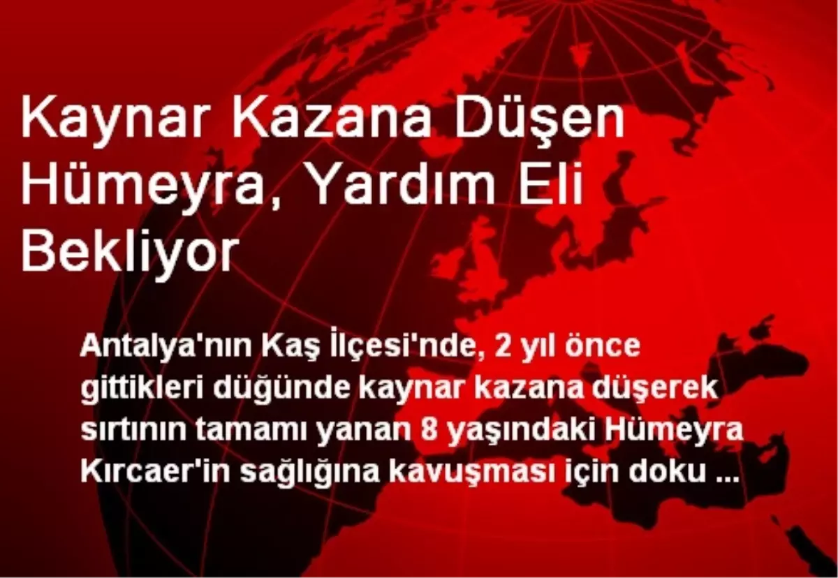 Antalya\'da Kaynar Kazana Düşen Hümeyra, Yardım Eli Bekliyor