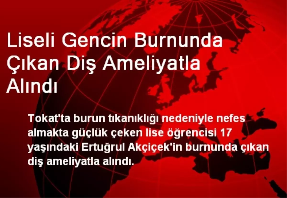 Liseli Gencin Burnunda Çıkan Diş Ameliyatla Alındı