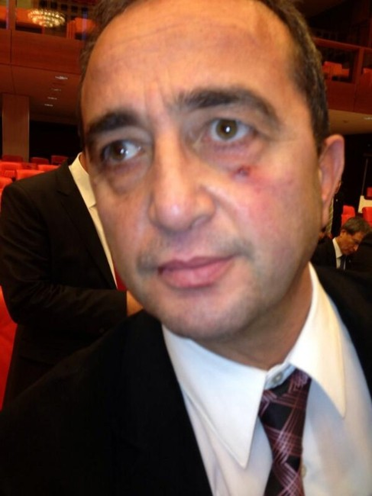 TBMM\'de Yumruklu Kavga