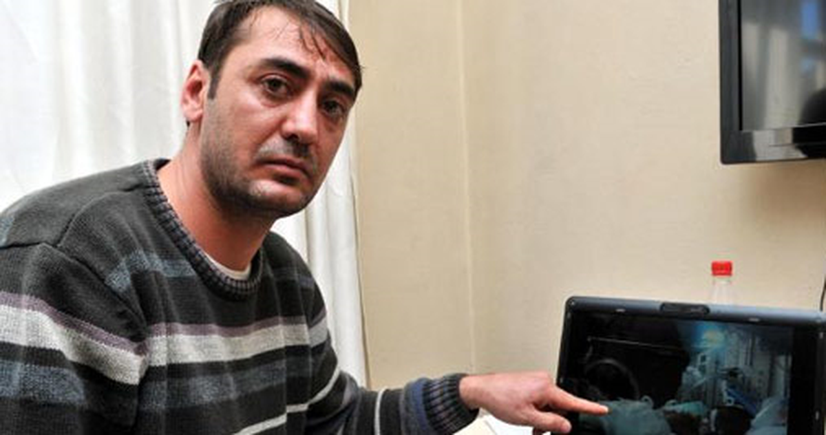 23 Günlük Özge Bebeğin Kangren Olan Bacağı Kesilecek