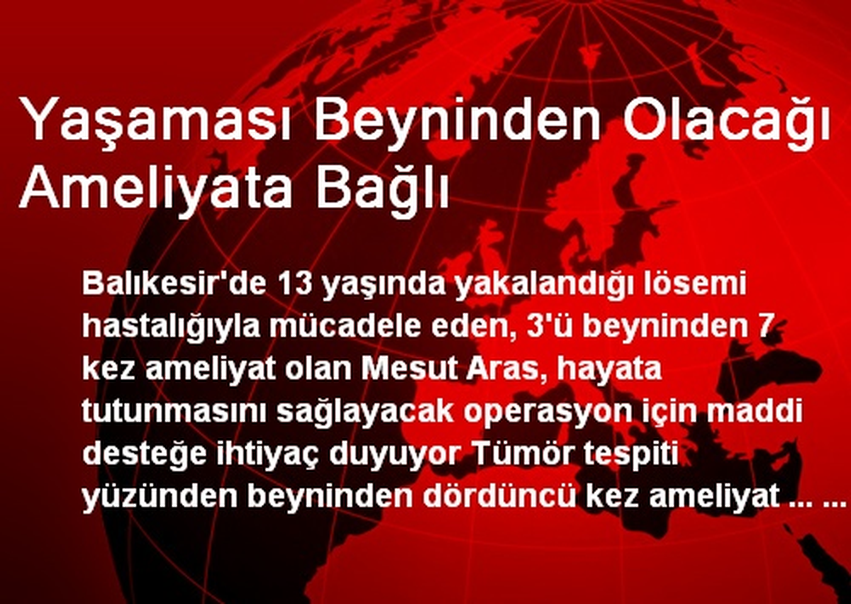 Yaşaması Beyninden Olacağı Ameliyata Bağlı