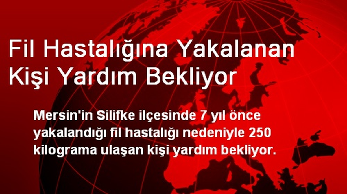 Fil Hastalığına Yakalanan Kişi Yardım Bekliyor
