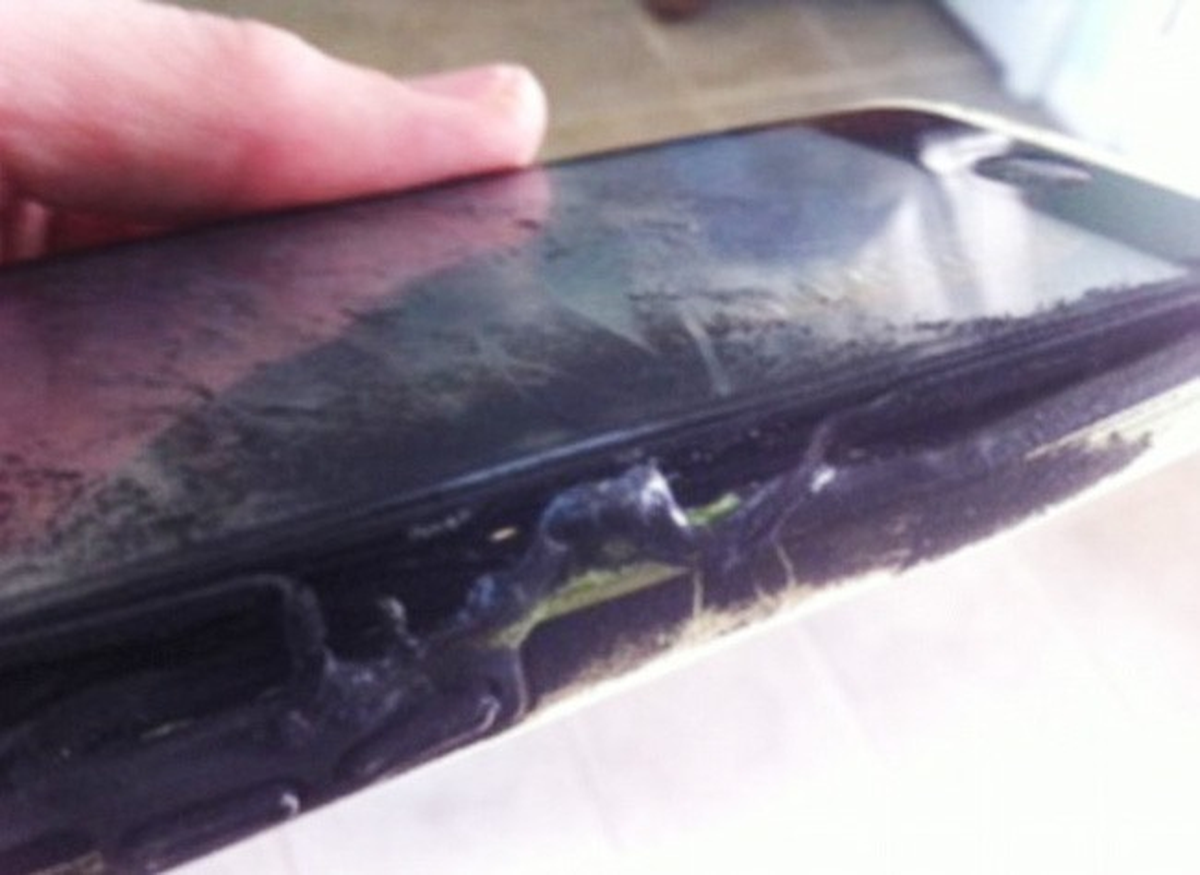 13 Yaşındaki Kızın İphone\'u Cebinde Alev Aldı