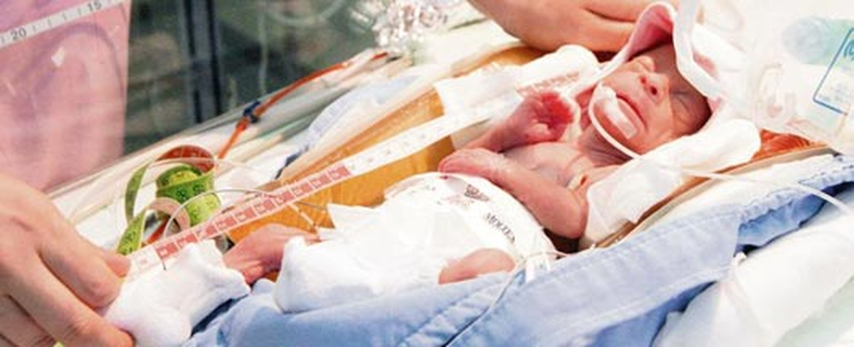 670 Gram Dünyaya Gelen Suriyeli Bebek Hayata Tutundu