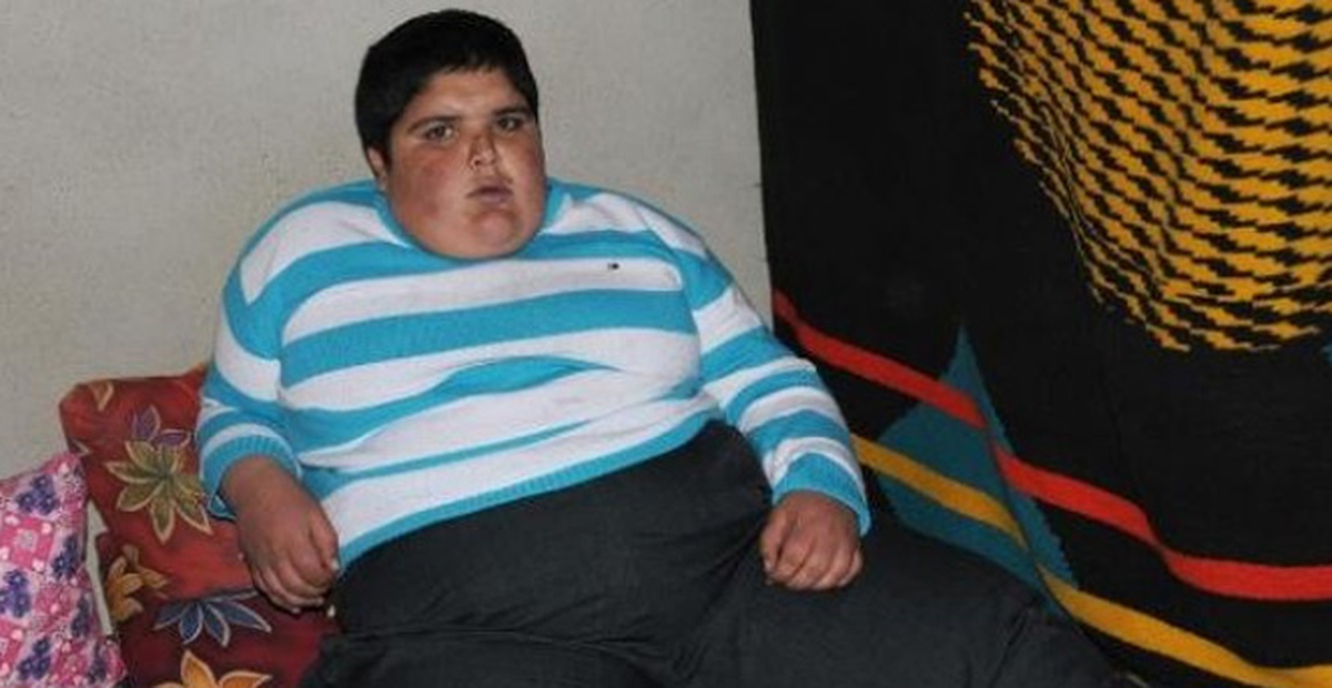 11 Yaşında 140 Kilo