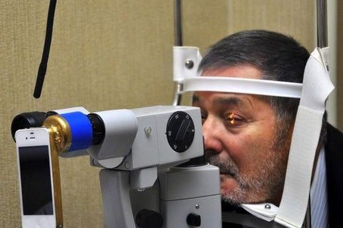 Kanser Gözden Teşhis Edilebiliyor 
