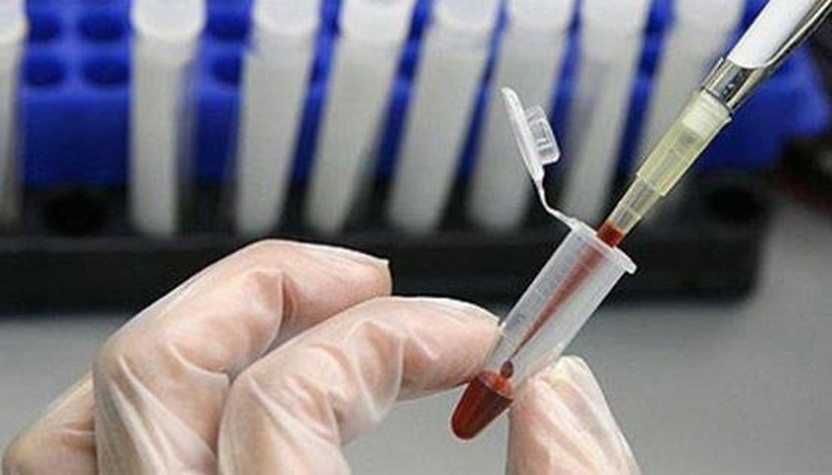 Kanser Savaş Derneği Başkanı Özbilen Açıklaması