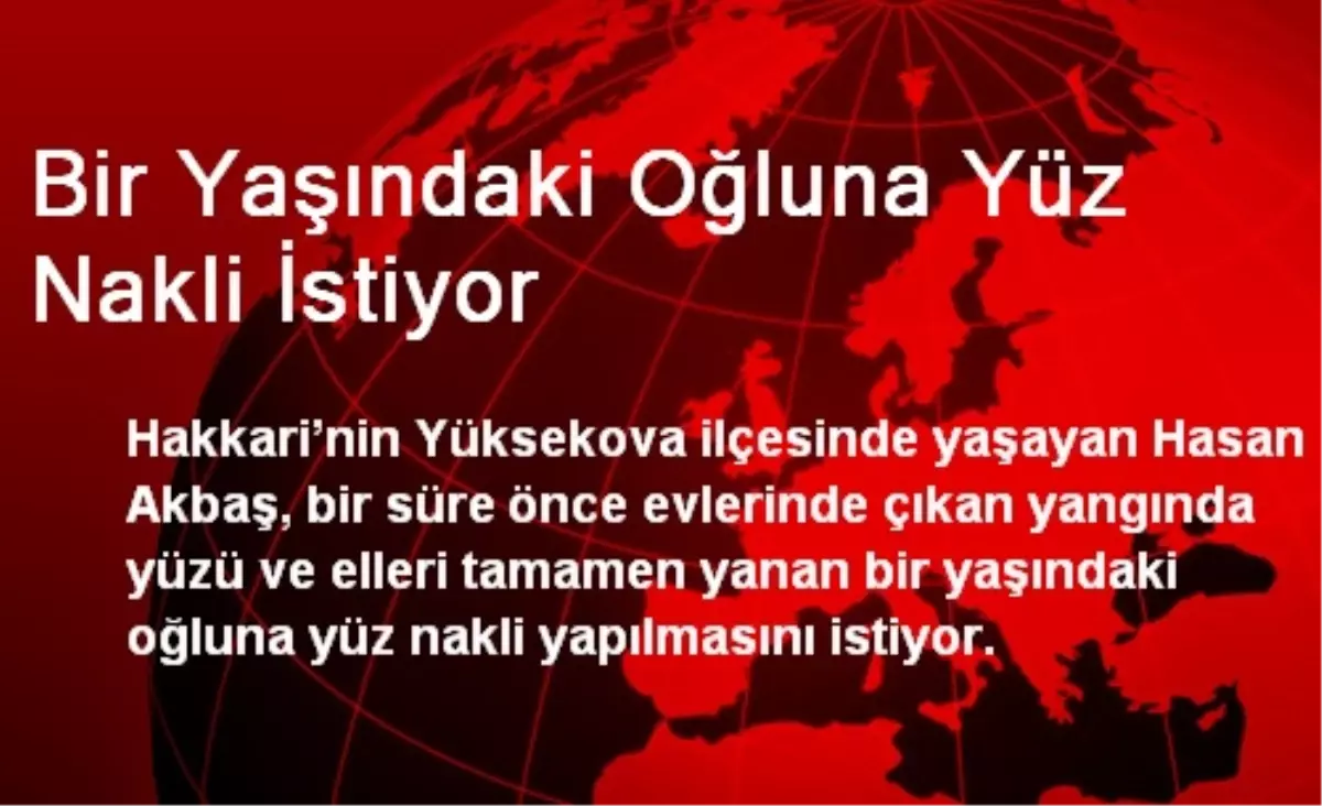 Bir Yaşındaki Oğluna Yüz Nakli İstiyor