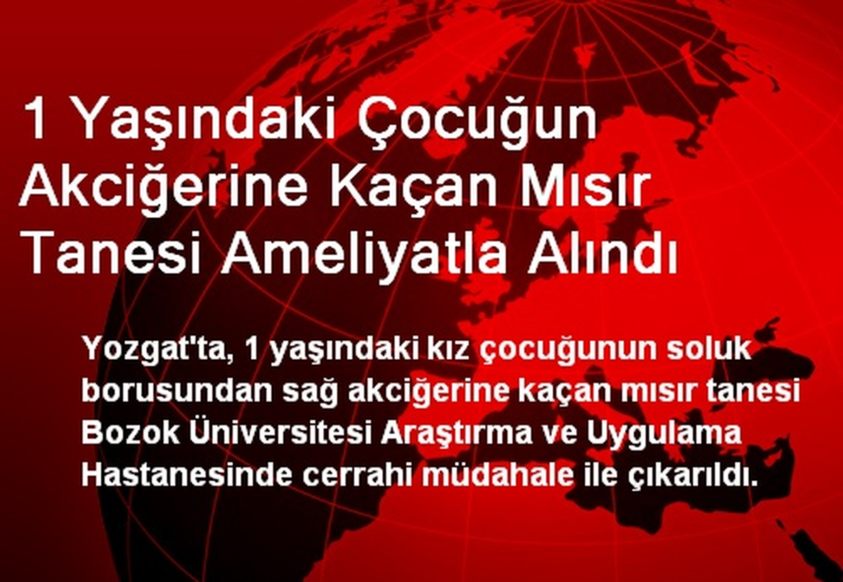 1 Yaşındaki Çocuğun Akciğerine Kaçan Mısır Tanesi Ameliyatla Alındı