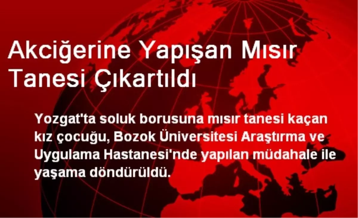 Akciğerine Yapışan Mısır Tanesi Çıkartıldı