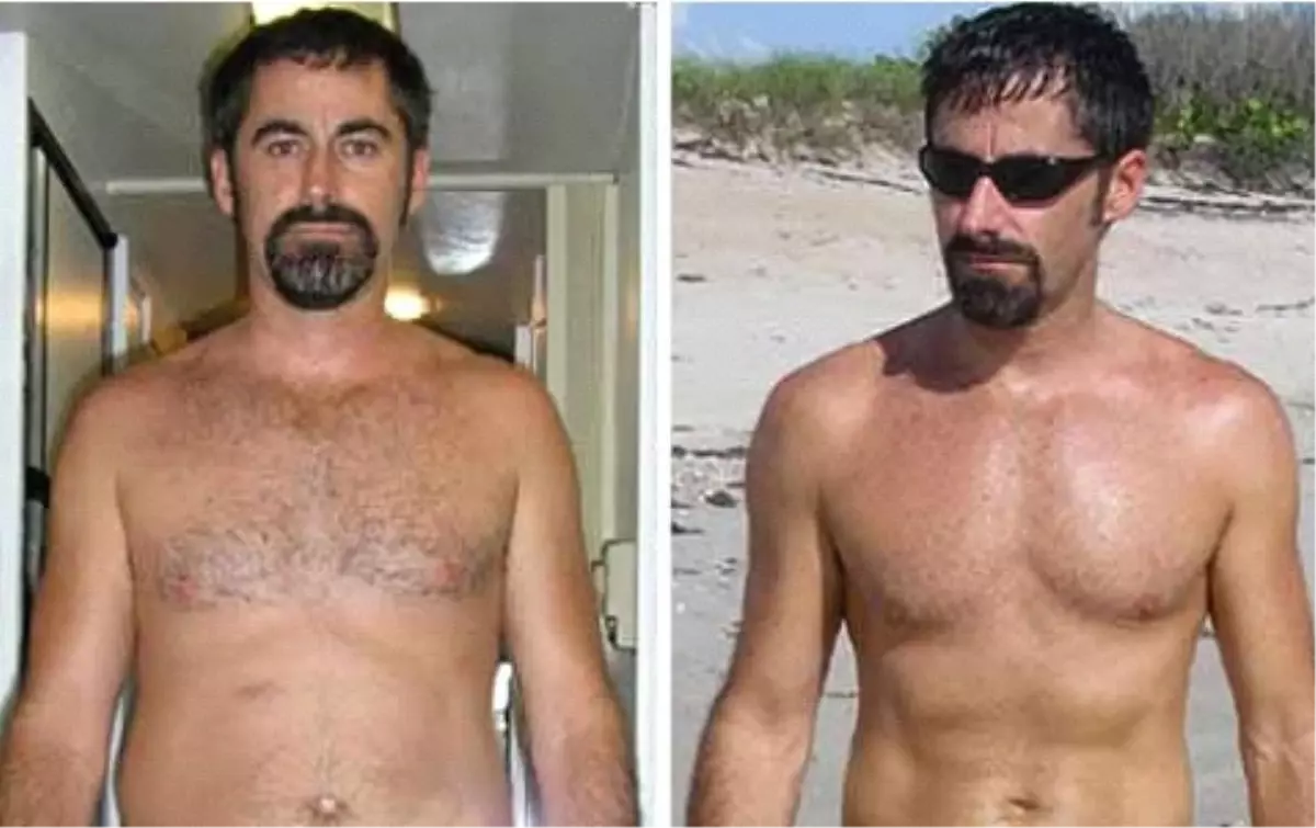 Amerikanlar Kilo Verme Konusunda İddalı, Fakat Rekoru Kıran Bir Türk Oldu!