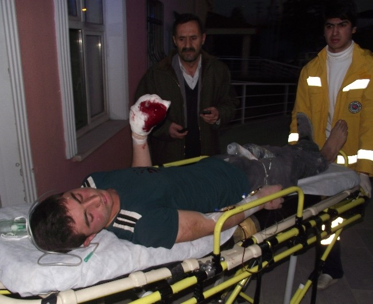 Döner Bıçağı ile Eli Kesildi