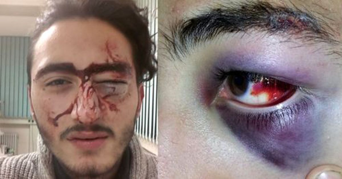 Eve Çağırdığı Polislerden Dayak Yedi