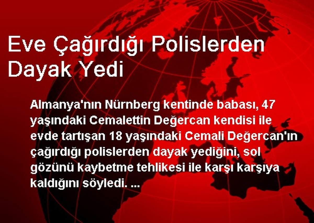 Eve Çağırdığı Polislerden Dayak Yedi