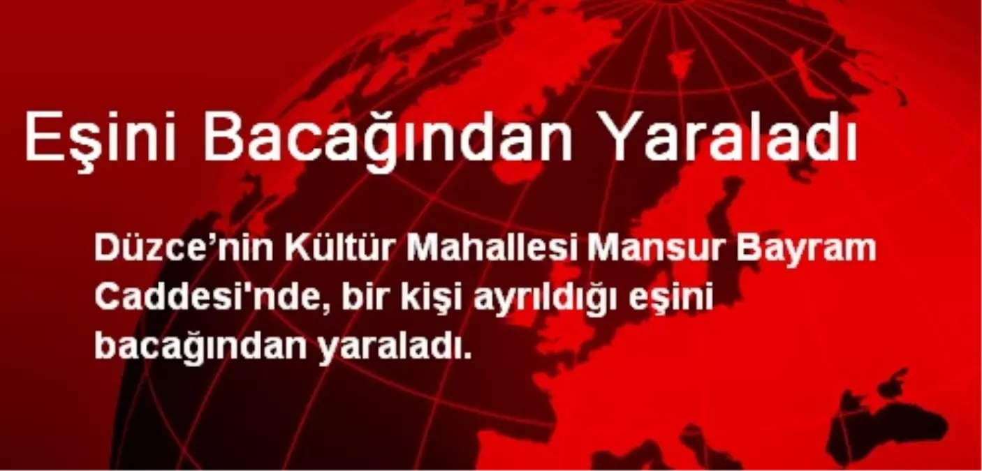 Eşini Bacağından Yaraladı