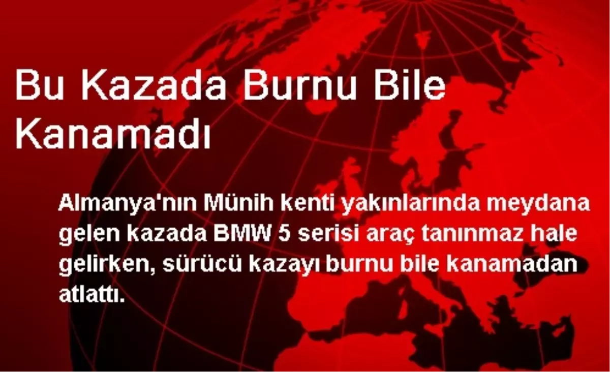 Bu Kazada Burnu Bile Kanamadı