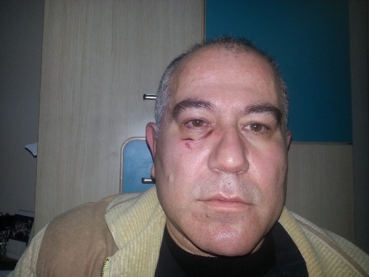 Gece Habere Giden Gazeteciyi Sokak Arasında Darp Ettiler