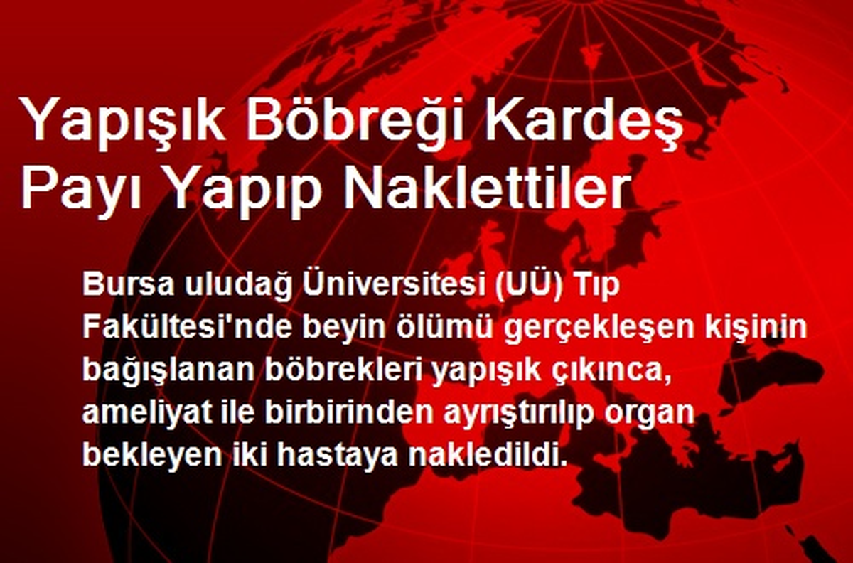 Yapışık Böbreği Kardeş Payı Yapıp Naklettiler