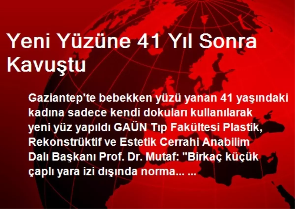 Yeni Yüzüne 41 Yıl Sonra Kavuştu