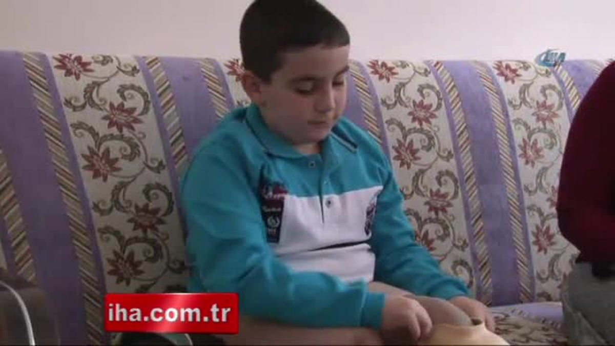 Arda\'ya Protez Yapılmazsa İki Bacağı da Kesilecek