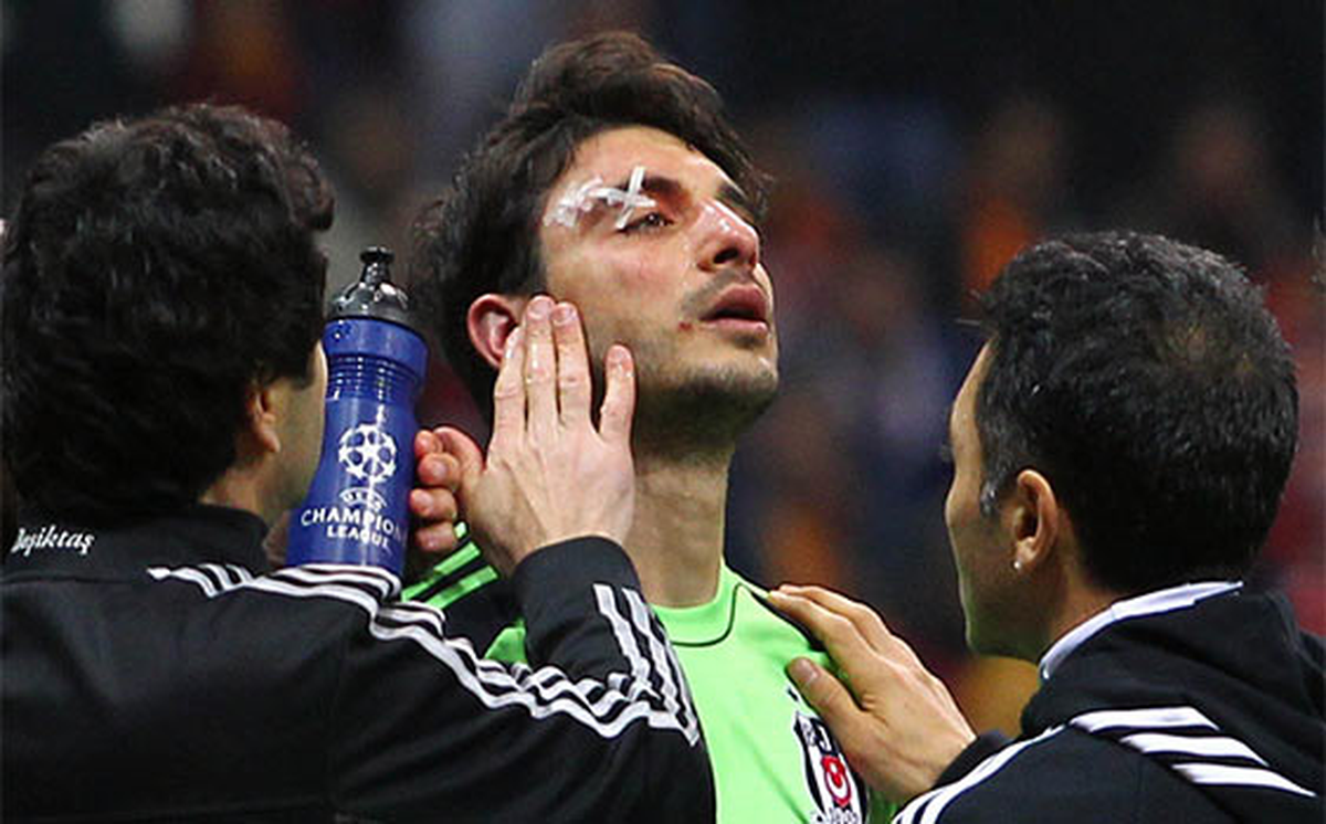 Beşiktaş Futbol Takımı Doktoru Karanlık Açıklaması