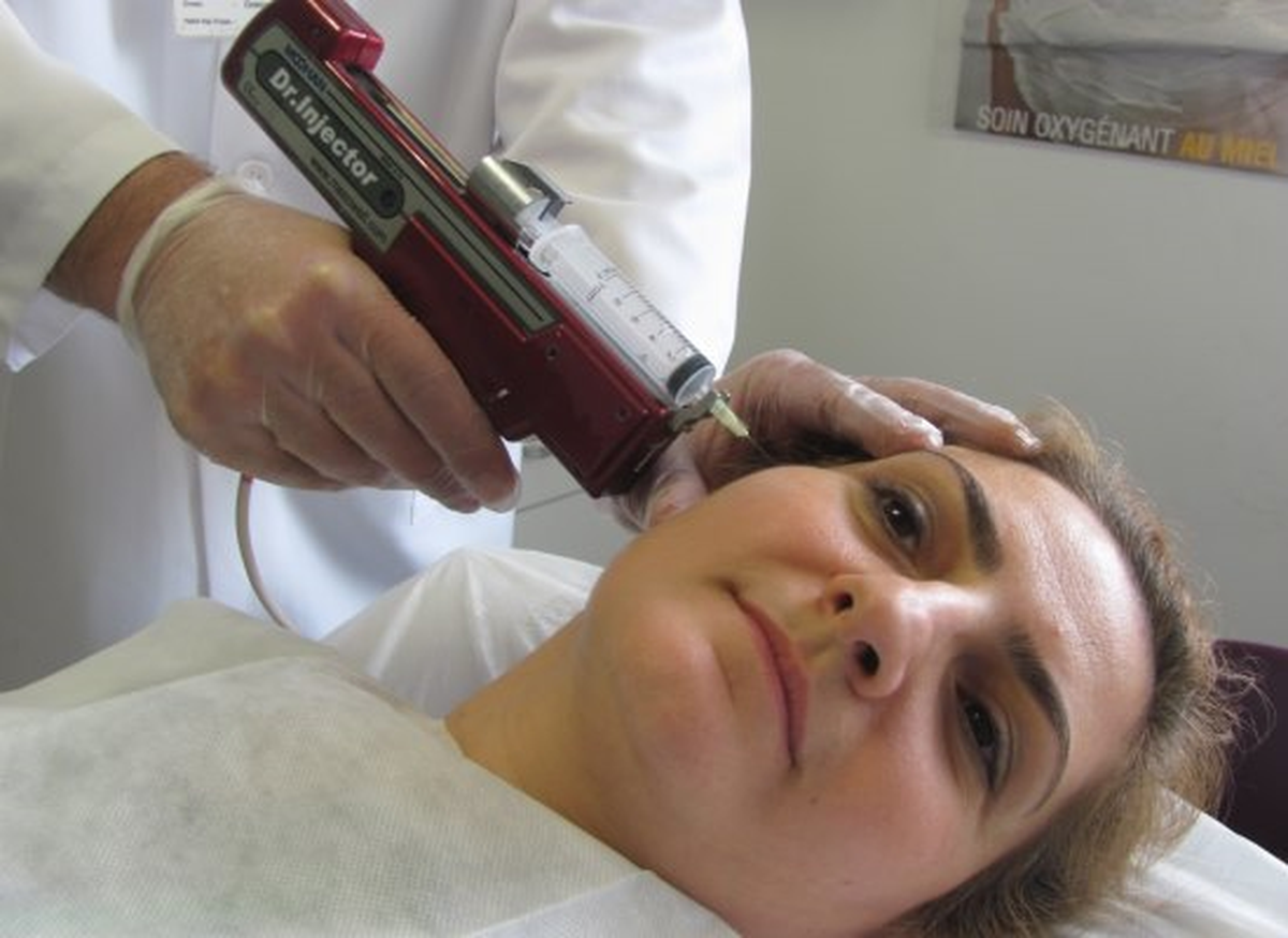 Hyaluronik Asitli Estetik Dolgu ile Gençleşirken Doğal Görünün