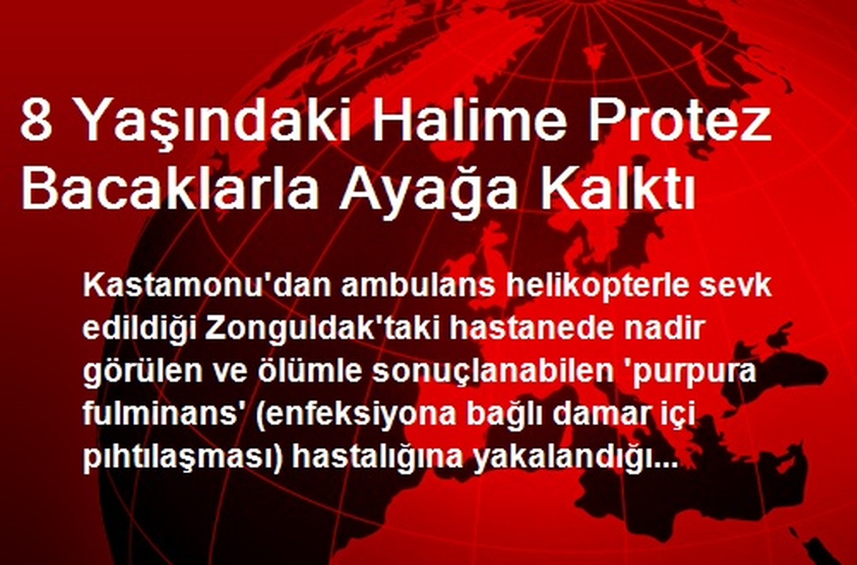 8 Yaşındaki Halime Protez Bacaklarla Ayağa Kalktı