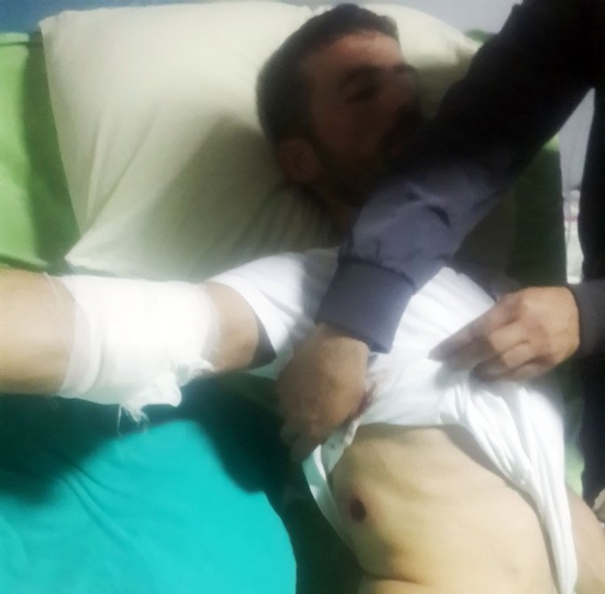 Ateşli Silahla Yaralanan Gencin Tedavisi Sürüyor