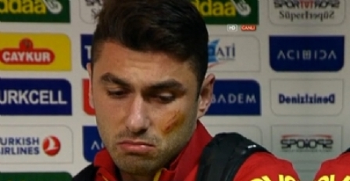 Çaykur Rizespor\'dan Burak Yılmaz Açıklaması