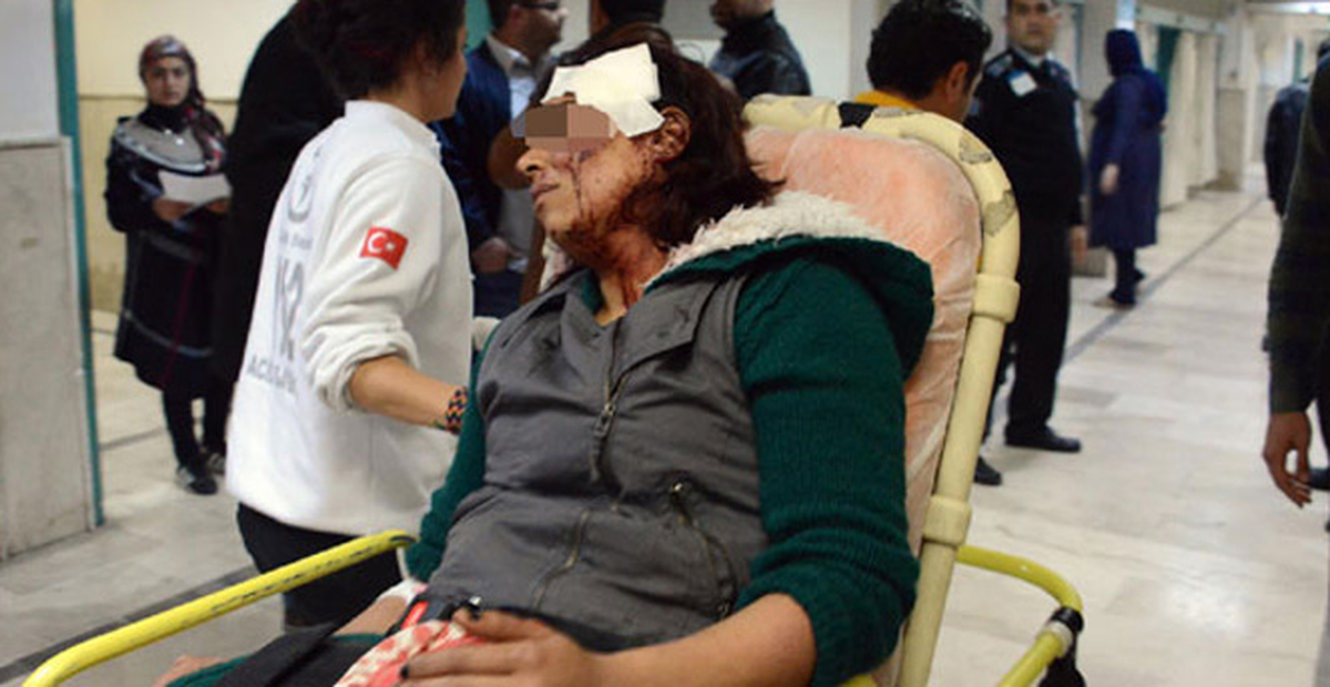 20 Yaş Küçük Sevgilisini Başına Taşla Vurarak Ağır Yaraladı