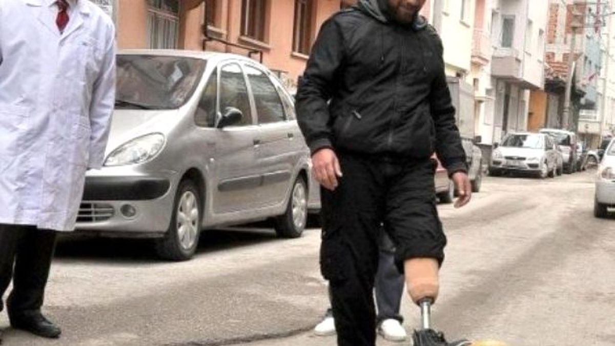 Hayata Protez Bacakla Adım Atıyorlar