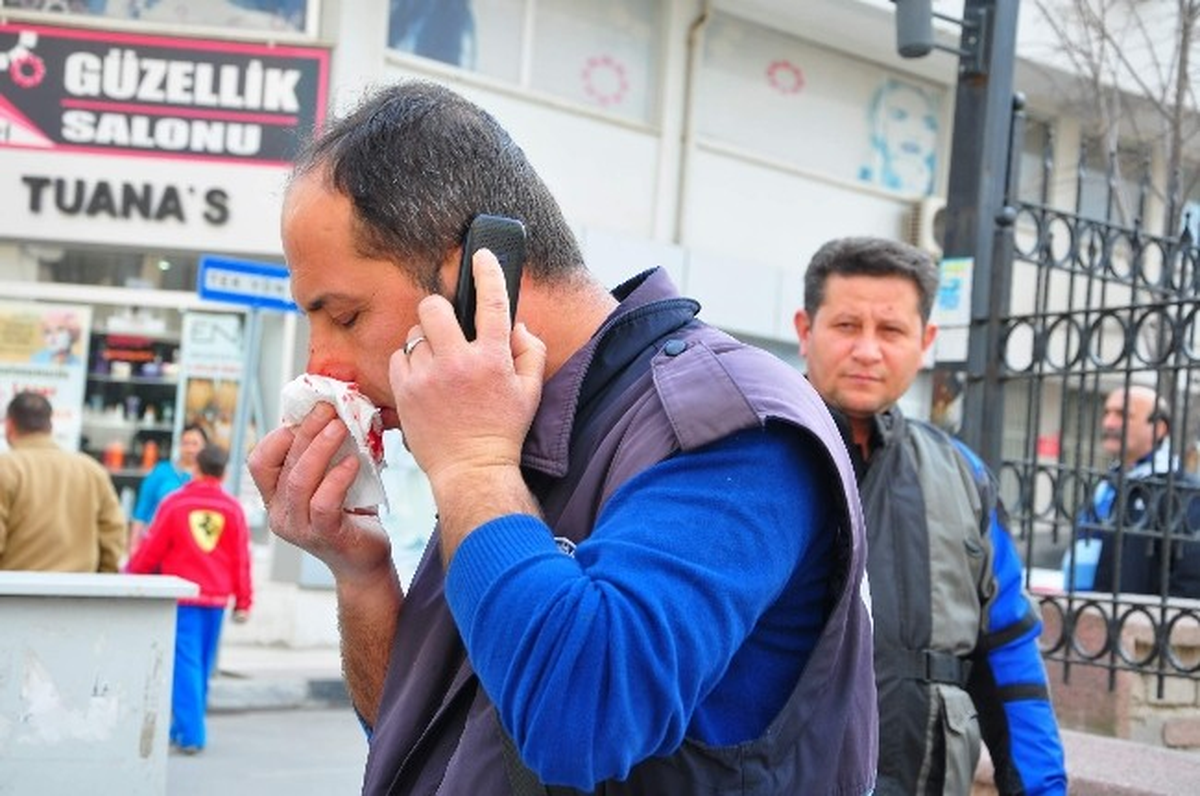 Aracına Park Cezası Yazan Besot İşçisini Darp Etti