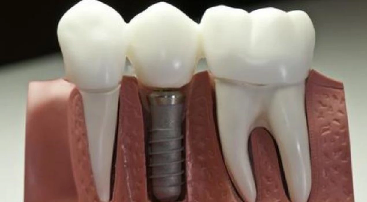 Reklamlardaki Yanlış Algı Çocuklarda Diş Çürümesi Nedeni