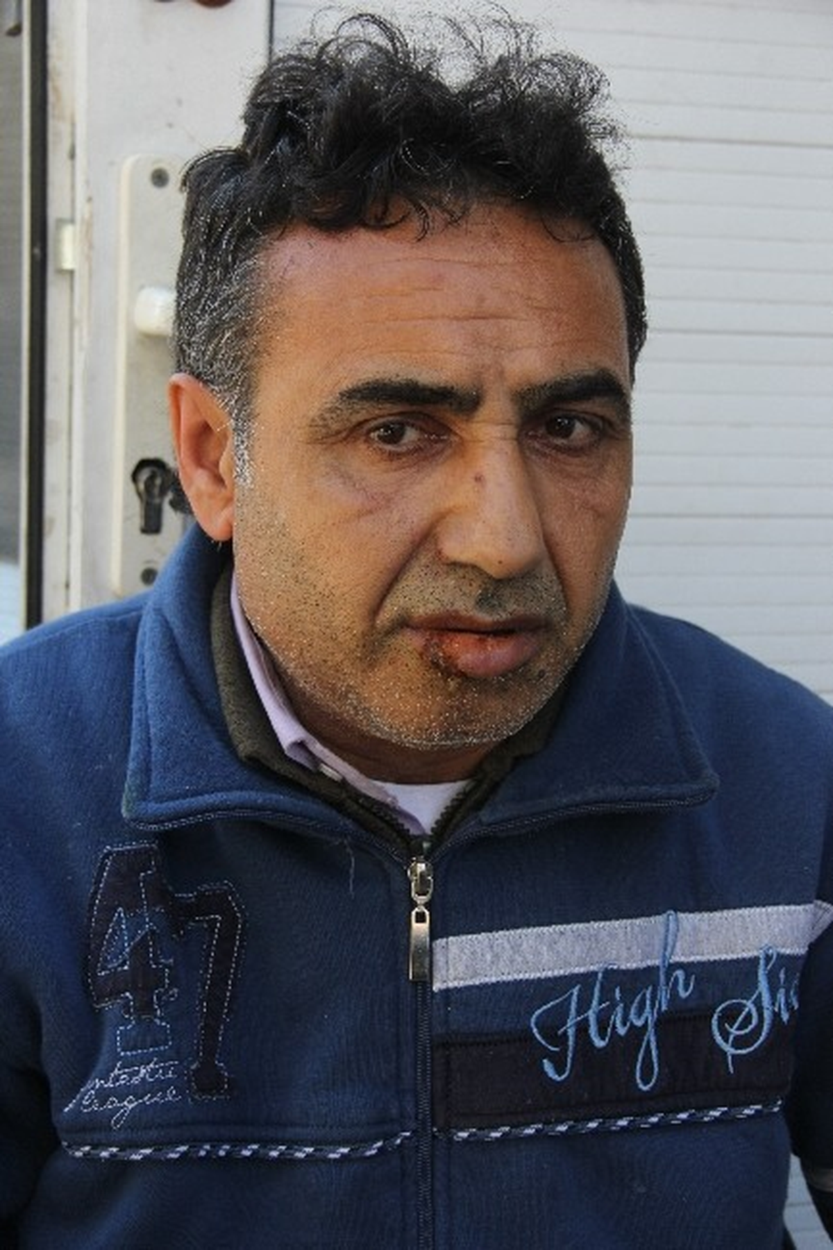 Şemsiyeyi Açtı, Yıldırım Çarptı