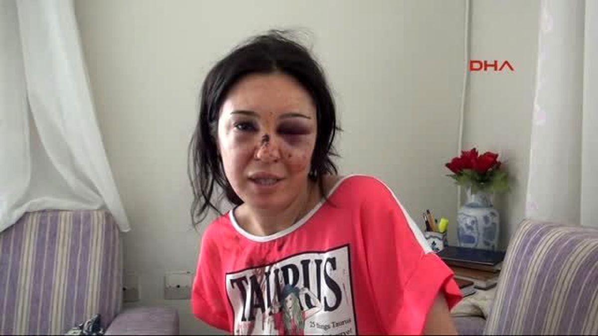 Boşanmak İsteyen Eşini Balıkesir'den İzmir'e Kadar Dövdü