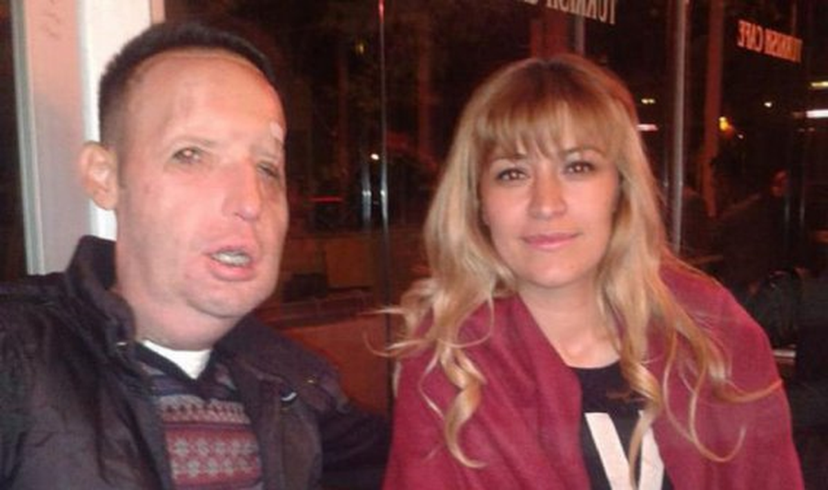 Önce Yüzü, Sonra Hayatı Değişti