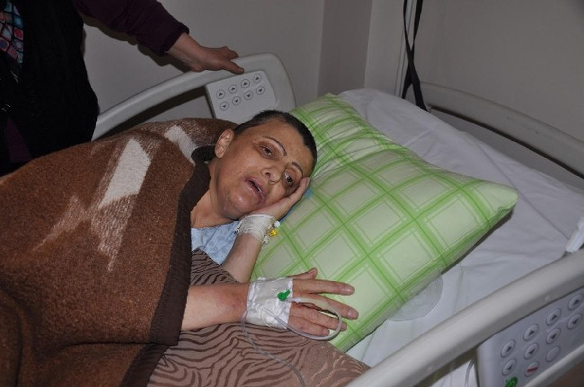 Başından Vurulan Kadın Hayata Tutundu