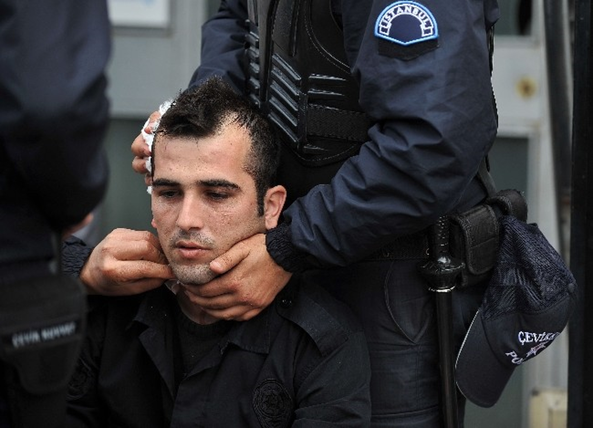 Kafasına Taş Gelen Polis Kanlar İçinde Kaldı