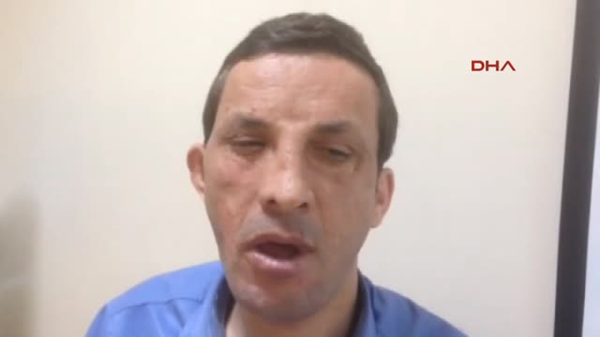 Türkiye\'nin İlk Yüz Nakillisi Uğur Acar\'da Herşey Yolunda