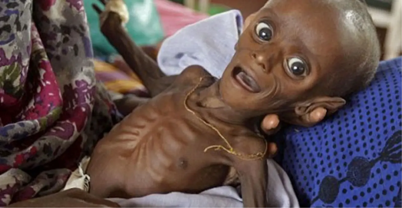 Dünyanın En Fakir 10 Ülkesi