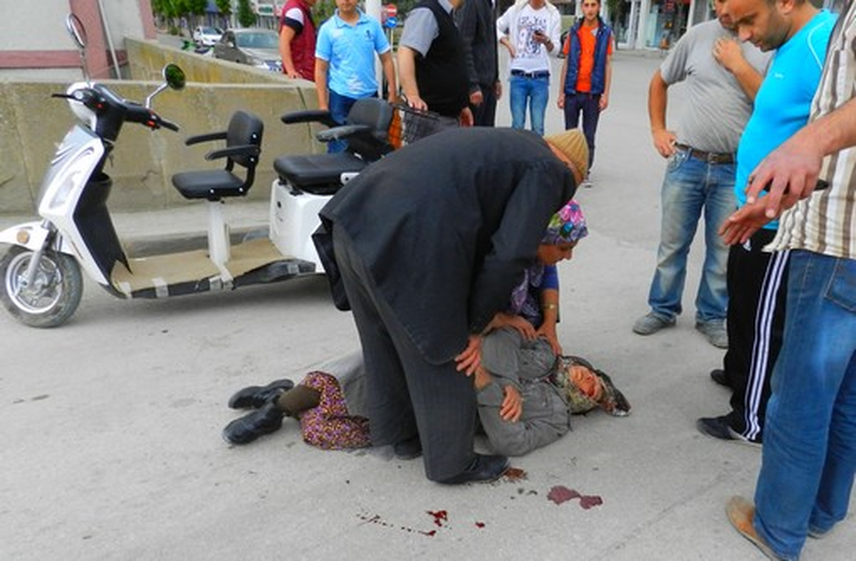 Osmancık\'ta 3 Tekerli Elektrikli Bisikletten Düştüler