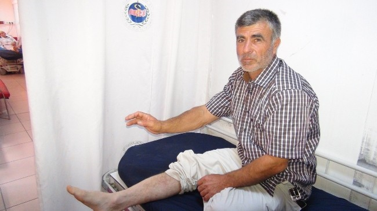 Aynı Anda İki Akrep Soktu