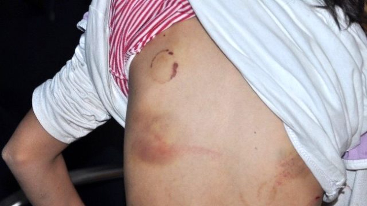 11 Yaşındaki Çocuğun Darp Edildiği İddiası