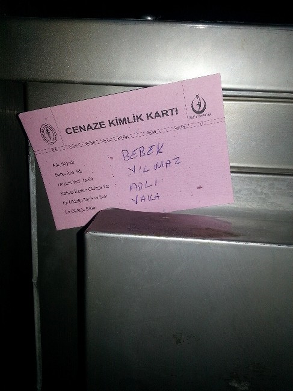 Doğum Yaparken Bebeğinin Bacağını Kesti