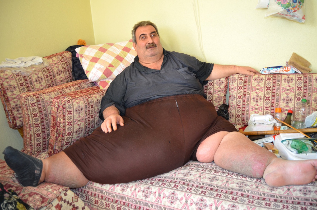 Silifke\'de Fil Hastası Ömer Tok, 4 Ayda 28 Kilo Verdi